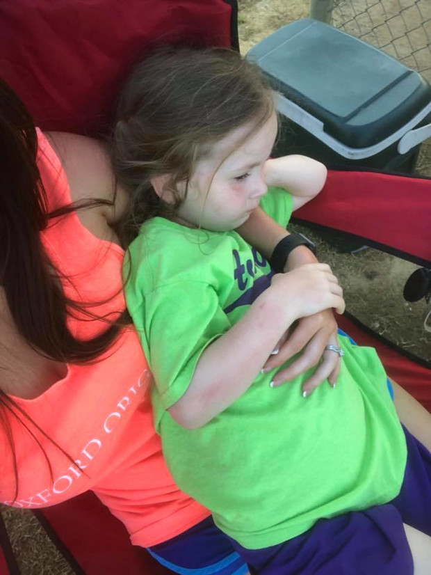 Az 5 éves kislány arra ébredt, hogy le van bénulva. Aztán észrevették mi van a fején…