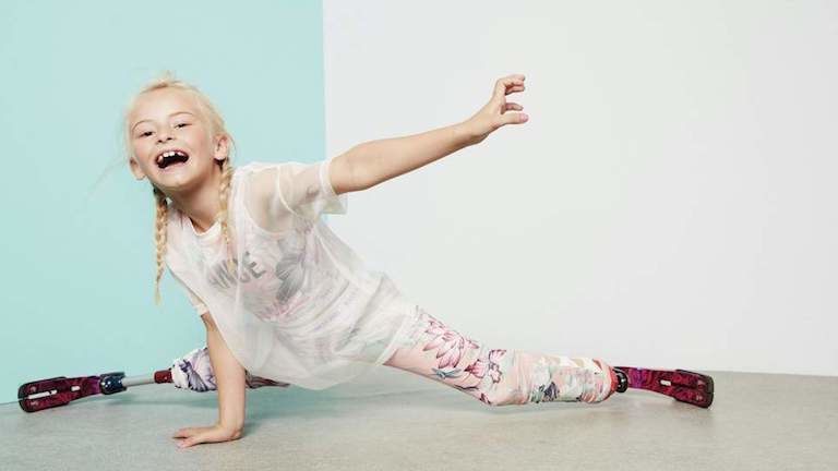 Amputált lábú kislányt kért fel modellnek a neves divatmárka