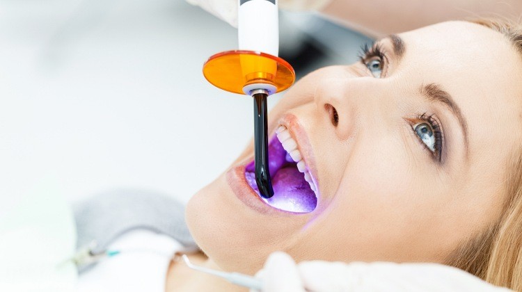 Ezért bízzuk orvosra a fogfehérítést